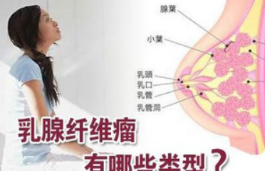 乳腺纤维瘤可以怀孕吗  乳腺纤维瘤影响怀孕吗
