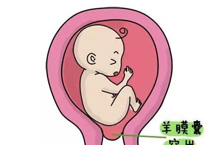 怕流产怎么办？容易流产是怎么回事