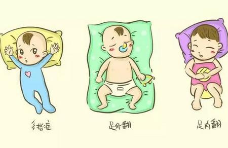 宝宝畸形产检能检查出来吗 最好的方法就是预防