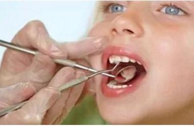 宝宝换牙期应注意什么