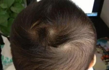 两个头旋的宝宝就聪明吗