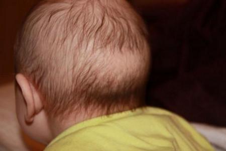 宝宝头上一圈枕秃怎么办