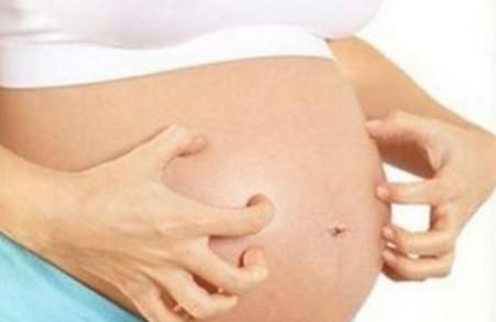 孕妇肚皮痒是怎么回事？