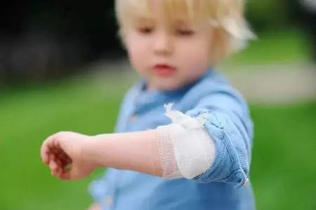 宝宝磕碰、擦伤怎么处理