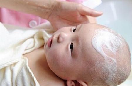 婴儿头上的胎脂能洗掉吗