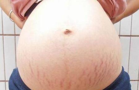 孕妇吃的胖胎儿反而小是怎么回事