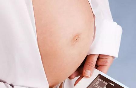 胎心监护的作用主要有哪些