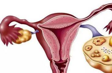 卵巢衰退的表现有哪些 卵巢衰退怎么调理