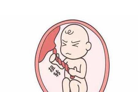 脐带扭转是什么原因