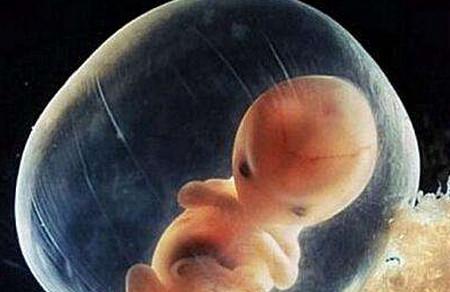 胚胎停育是什么原因导致的