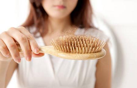 产后脱发原因及治疗