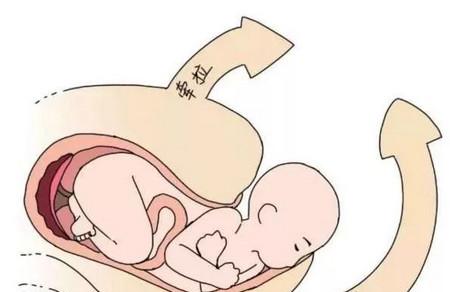 产后盆底肌力检查有必要吗