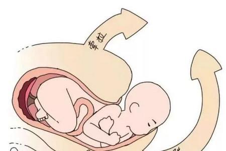 产后盆底肌力检查有必要吗