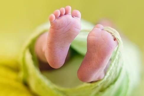 早产儿黄疸的特点 早产宝宝黄疸该怎么办