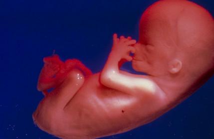 胎儿过小是什么原因造成的