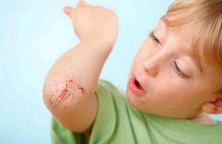 宝宝受这3种伤该怎么处理？