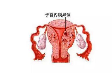 如何提高不孕女性怀孕成功率