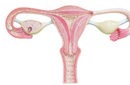输卵管堵塞是怎么回事