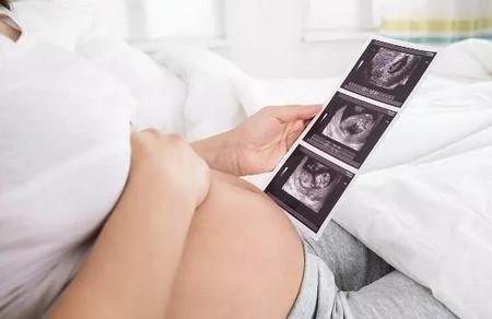 这4类孕妇不适合孕期运动！
