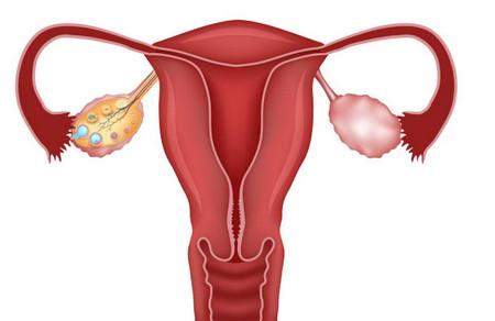 多囊女性怎么快速备孕