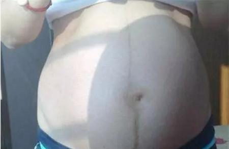 怀孕生男症状哪个准？