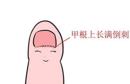 宝宝手上为什么有倒刺