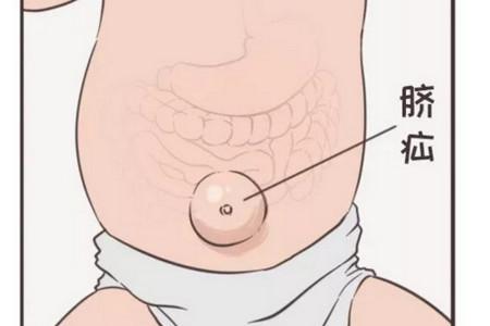 宝宝出现脐疝怎么办
