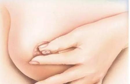 乳头瘙痒是乳腺癌吗 乳腺癌有哪些症状