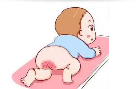 宝宝红屁屁怎么回事  宝宝红屁屁怎么护理好