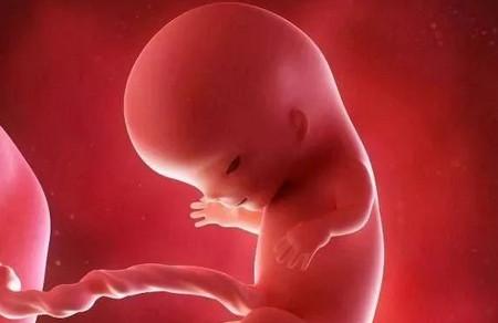 孕期唐筛有必要做吗