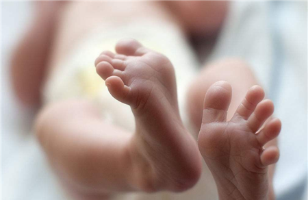 剖腹产对新生儿有什么影响