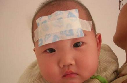 宝宝发烧需要退烧贴吗