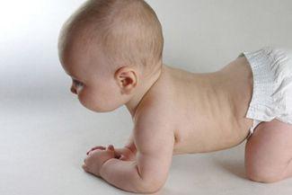 宝宝大脑发育迟缓的症状