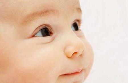 宝宝塌鼻梁、斗鸡眼该怎么办