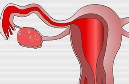 输卵管堵塞有没有明显的症状？