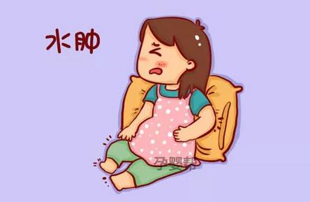 如何缓解孕期水肿？