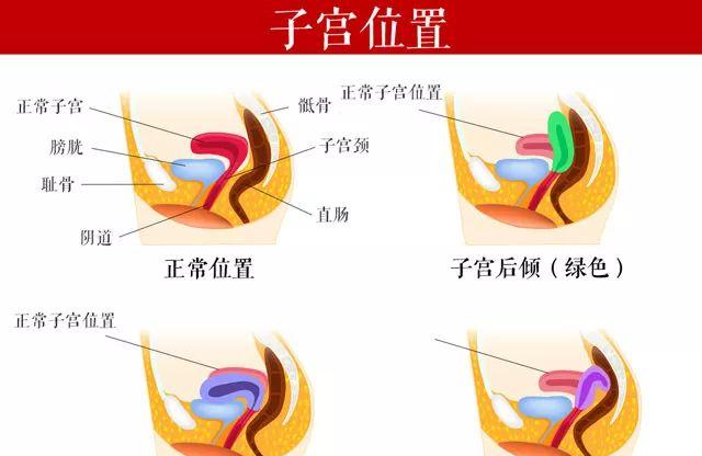生理期腰酸经痛的原因