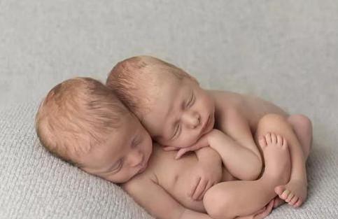 真假双胞胎：你了解“重孕”现象吗？