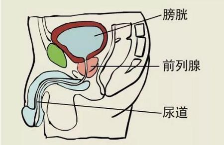 前列腺炎是怎么引起男性不育的？