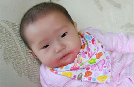 想要避免宝宝口水疹该怎么办