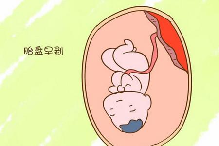 什么原因引起胎盘早剥