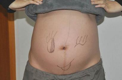 孕妇三个月需要检查啥
