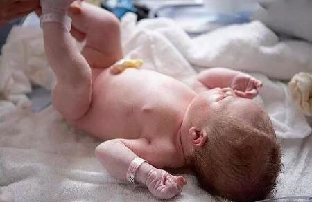 新生儿脐带怎么护理