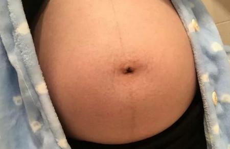 孕妇怀男宝宝的症状有哪些