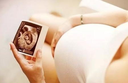 这几类孕妇顺产的几率较小