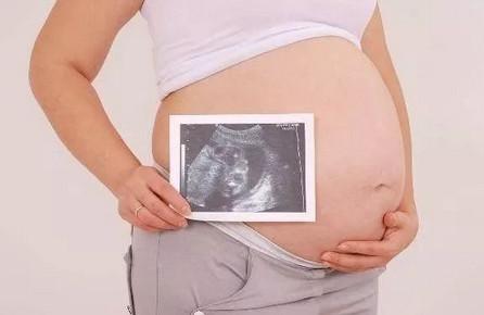 孕期显怀和不显怀有关系吗