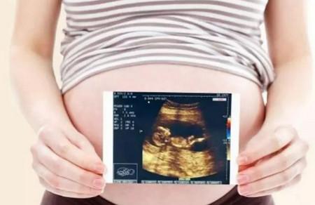 孕妈做四维彩超前要先了解这3件事
