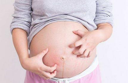 孕妇饮食营养应注意什么？