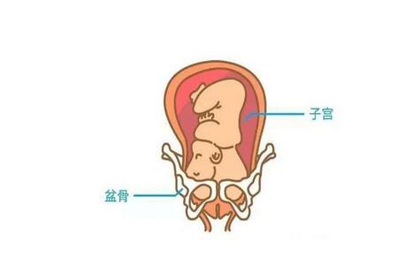 胎儿入盆后需要注意什么