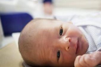 新生儿硬肿症是什么病